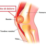Sindrome Femoro - Rotulea